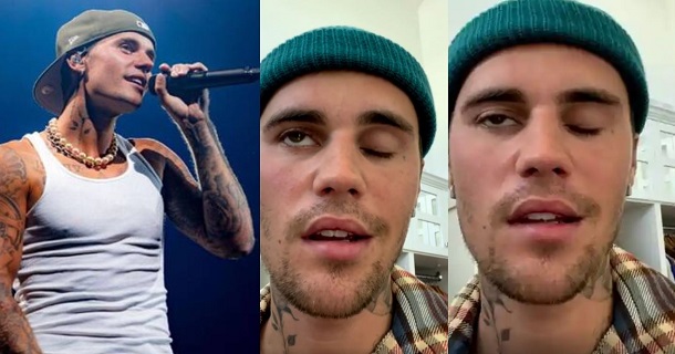Justin beiber got affected by rare syndrome video getting viral